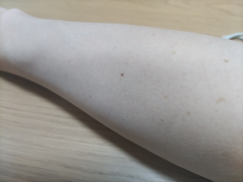 部分的な腕の画像